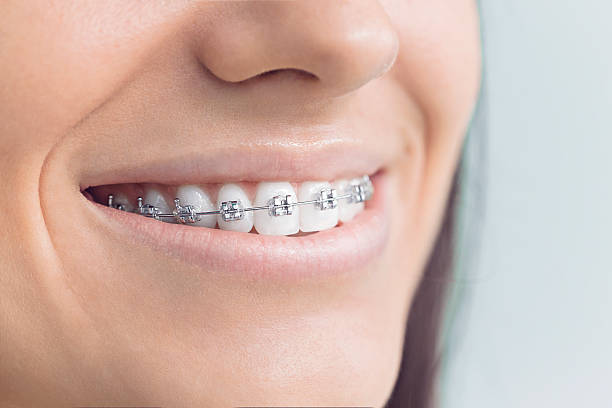 Best Invisalign and Clear Aligners  in Ford Heights, IL